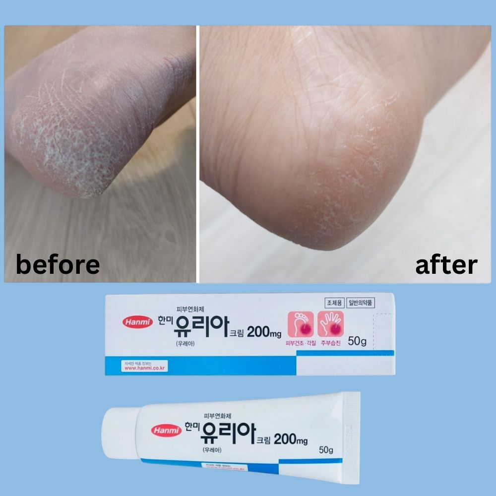 Hanmi ProCalm Foot Cream (50g)